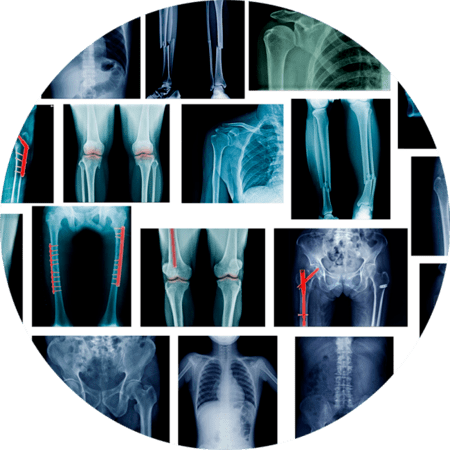 Lots of x-rays of body parts